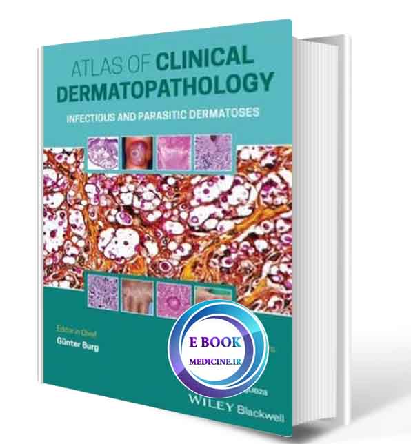 دانلود کتاب Atlas Clinical of Dermatopathology: Infectious and Parasitic Dermatoses2021 (Original PDF)